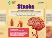 Tips Menurunkan Risiko Stroke Sejak Dini untuk Hidup Sehat