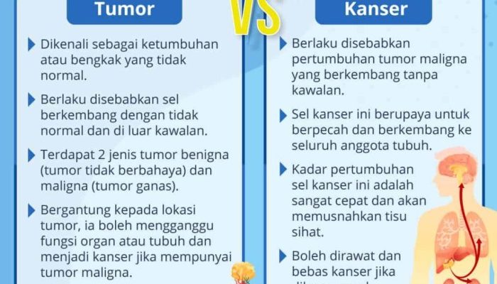 Dari Vonis Tumor Otak ke Kesembuhan, Ini Perjalanannya