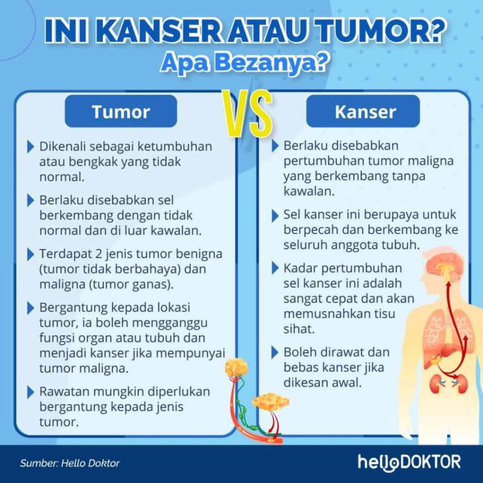 Kenali 11 Jenis Tumor Otak, dari yang Ringan hingga Ganas Dari Vonis Tumor Otak ke Kesembuhan, Ini Perjalanannya