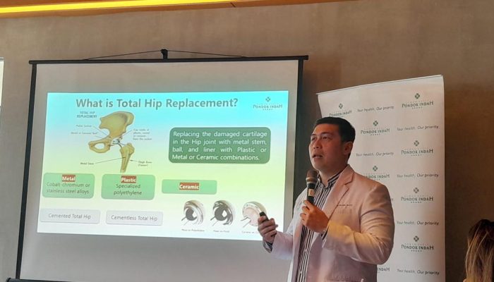 Penggantian Panggul Total Harapan Baru untuk Menjalani Hidup Lebih Aktif