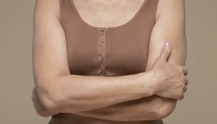 Pentingnya Merawat Lipatan Tubuh untuk Kulit yang Sehat