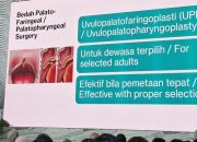 Mendengkur Tidak Menjadi Pertanda Tidur yang Berkualitas