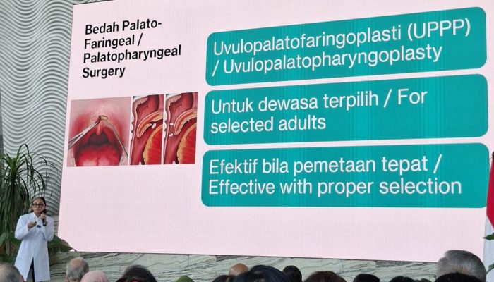 Mendengkur Tidak Menjadi Pertanda Tidur yang Berkualitas