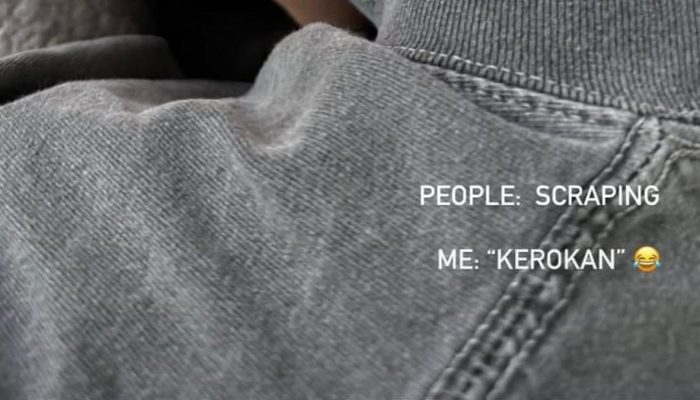 Agnez Mo Heboh Usai Unggah Foto Leher Memerah, Pahami Manfaat dan Risiko Kerokan