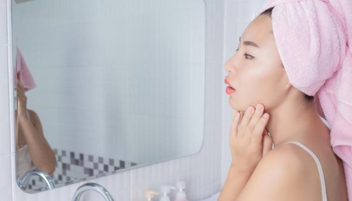 Penyebab Jerawat Hormonal dan Cara Mengatasi Tanpa Bekas